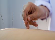 Ce este acupunctura și de ce ar trebui încercată